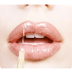 Dermal Fillers Dr